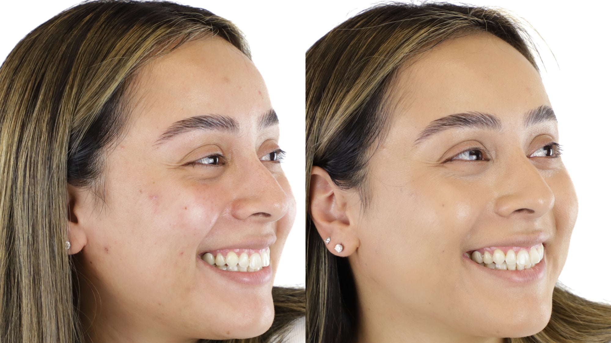 Mineralogie Clear Liquid Zinc Before & After